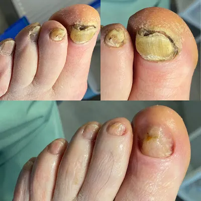 Instytut Podologii Klaudia Wilk - Podolog Zabrze